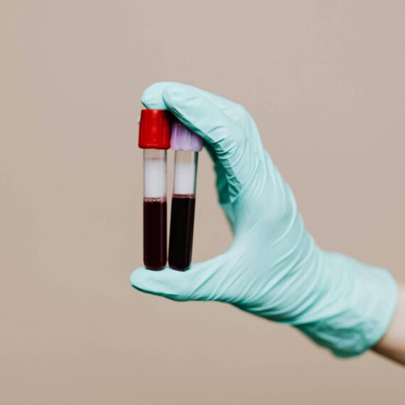 Exames de sangue para ciclistas