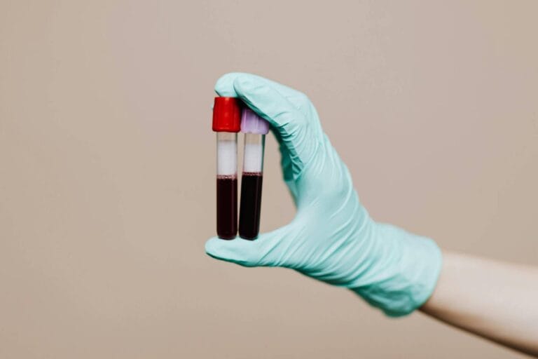 Exames de Sangue para Ciclistas: Saúde, Performance e Desempenho