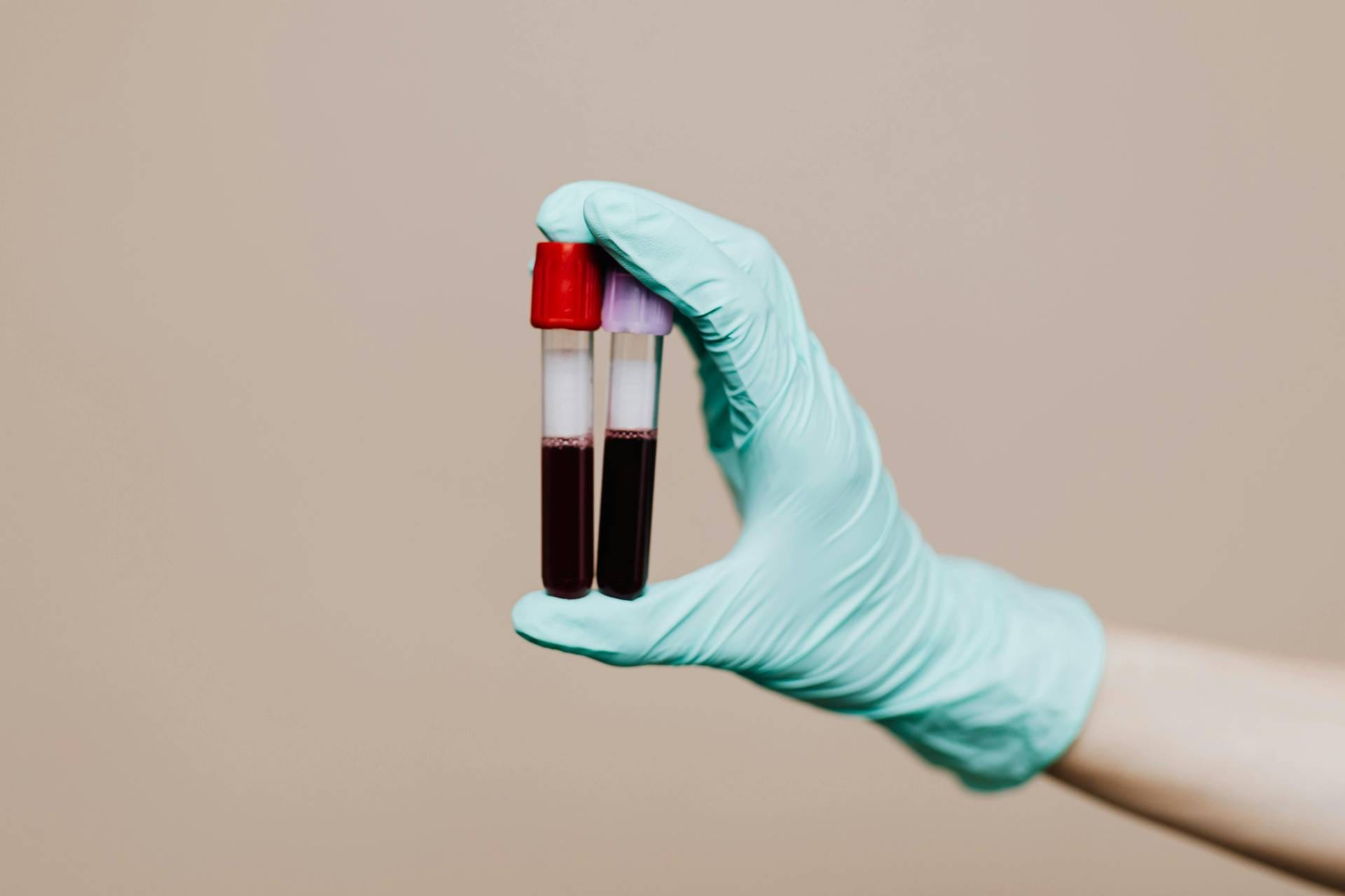 Exames de Sangue para Ciclistas: Saúde, Performance e Desempenho