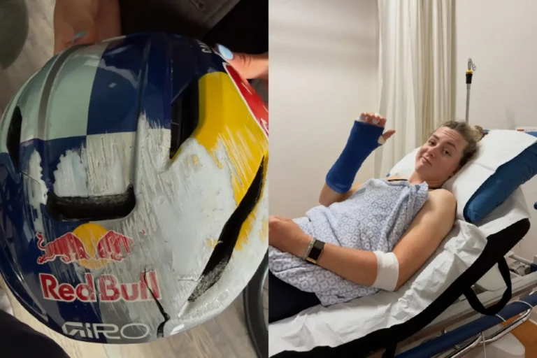 Meu Capacete Salvou Minha Vida: Zoe Bäckstedt Fica Fora das Primeiras Provas de Ciclocross Após Acidente de Treino