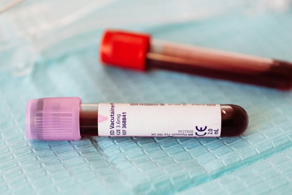 A Arginina Aumenta a Testosterona?