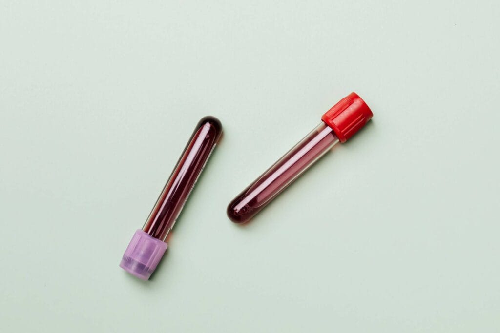 Frascos com sangue em cima de uma mesa branca.